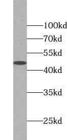 TRIB2 Antibody - BSA Free