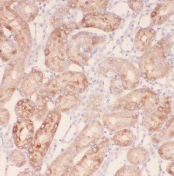 TRAPPC9 Antibody - BSA Free