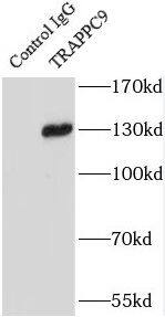 TRAPPC9 Antibody - BSA Free