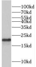 TRAPPC3 Antibody - BSA Free