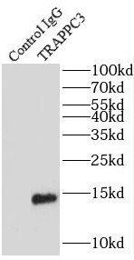 TRAPPC3 Antibody - BSA Free