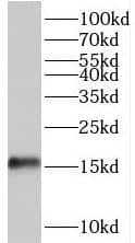 TRAPPC2L Antibody - BSA Free