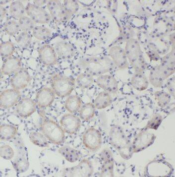 TRAPPC2L Antibody - BSA Free