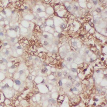 ALS2CR3 Antibody - BSA Free