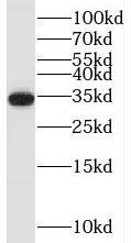 TRA2A Antibody - BSA Free