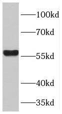 TPTE2 Antibody - BSA Free