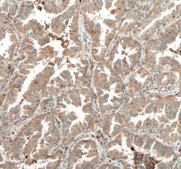 TPSD1 Antibody - BSA Free