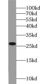 TPSD1 Antibody - BSA Free
