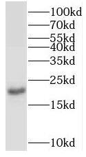 TPRKB Antibody - BSA Free