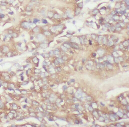 TPK1 Antibody - BSA Free