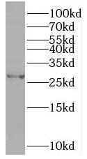 TPK1 Antibody - BSA Free