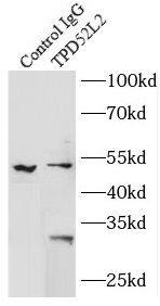TPD52L2/D54 Antibody - BSA Free