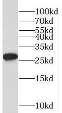 TPD52L2/D54 Antibody - BSA Free
