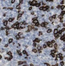 STX11 Antibody - BSA Free