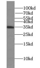 STX11 Antibody - BSA Free