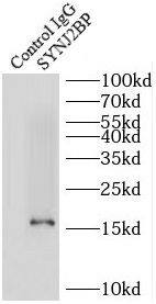 SYNJ2BP/ARIP2 Antibody - BSA Free