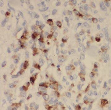 SYNJ2BP/ARIP2 Antibody - BSA Free