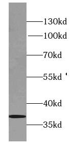 Synaptoporin Antibody - BSA Free