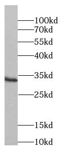 Synaptogyrin 4 Antibody - BSA Free