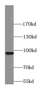 STT3B Antibody - BSA Free
