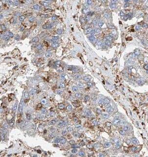 STT3A Antibody - BSA Free