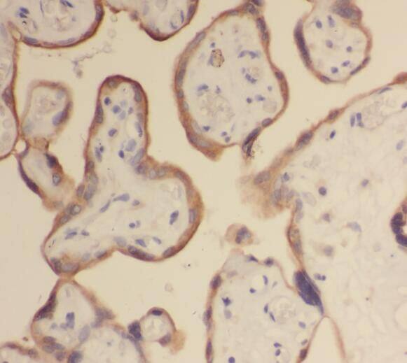 Steroid sulfatase Antibody - BSA Free