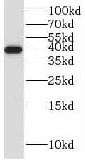 ALS2CR2 Antibody - BSA Free