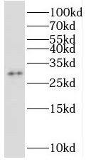 STOML3 Antibody - BSA Free
