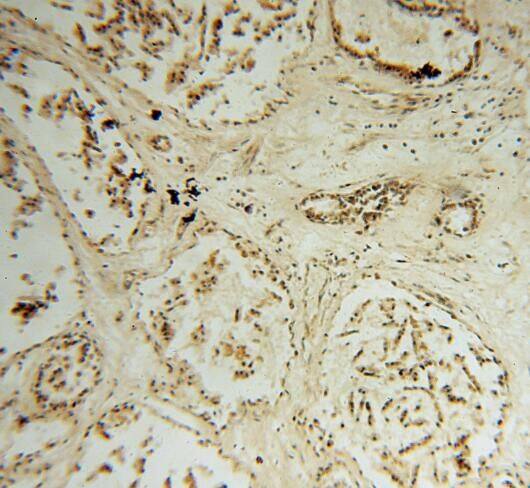 STK36 Antibody - BSA Free