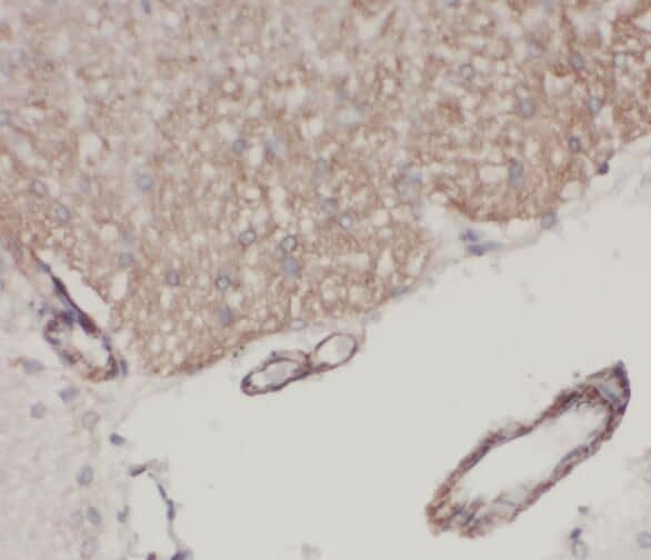 STK32A Antibody - BSA Free
