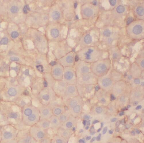 STEAP3/TSAP6 Antibody - BSA Free