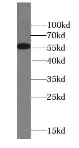 STEAP2 Antibody - BSA Free