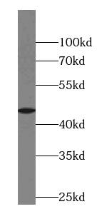 ABRA Antibody - BSA Free