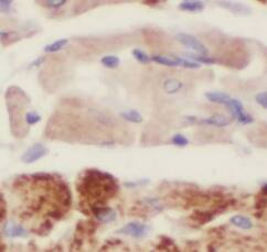 ABRA Antibody - BSA Free