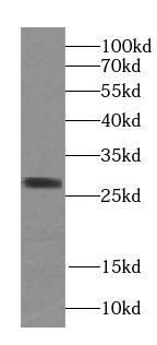 STARD3NL Antibody - BSA Free