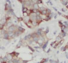 STARD3NL Antibody - BSA Free
