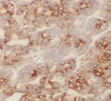 ST8SIA3 Antibody - BSA Free