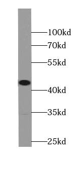 ST8SIA3 Antibody - BSA Free