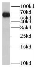 ST7L Antibody - BSA Free