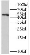 ST3GAL6 Antibody - BSA Free