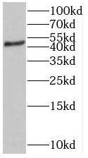 ST3GAL5 Antibody - BSA Free