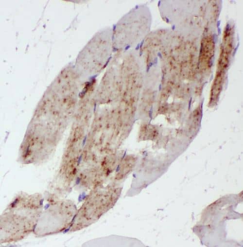 ST3GAL5 Antibody - BSA Free