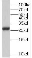 SSSCA1 Antibody - BSA Free