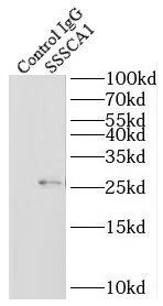 SSSCA1 Antibody - BSA Free