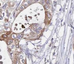 Signal sequence receptor delta Antibody - BSA Free
