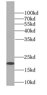 Signal sequence receptor delta Antibody - BSA Free