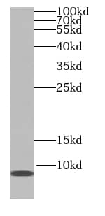 SS18L2 Antibody - BSA Free