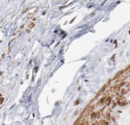 SS18L2 Antibody - BSA Free