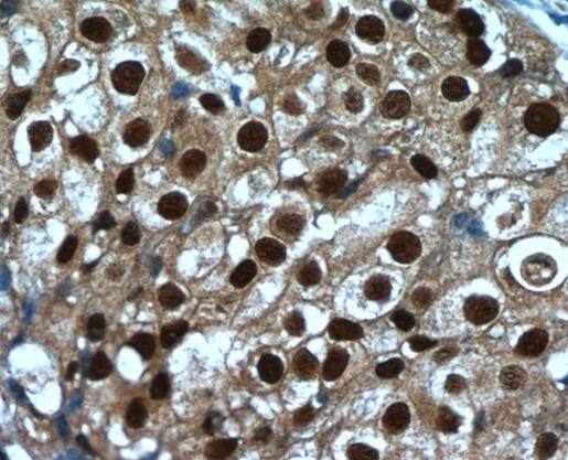 SRA1 Antibody - BSA Free