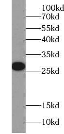 SRA1 Antibody - BSA Free